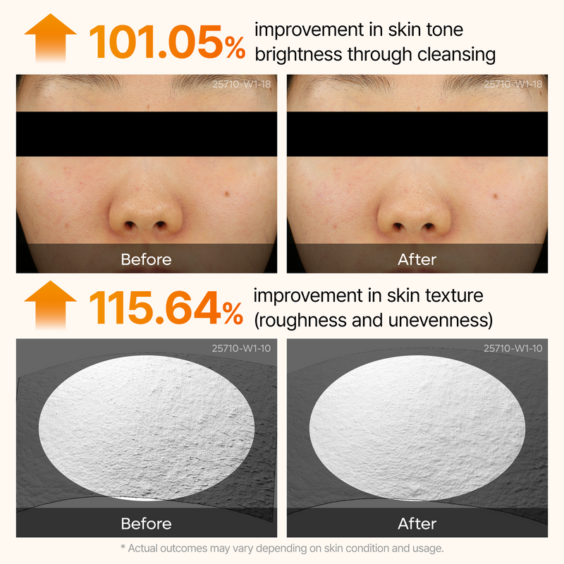 Kojic Acid Turmeric Brightening Routine Duo